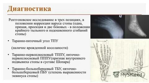 Врожденный травматологии