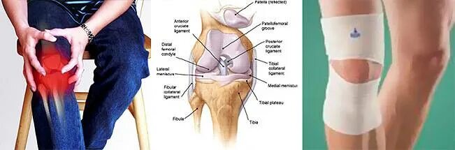 Боль под коленом спереди. Внутренняя сторона колена. Болит колено с внутренней стороны. Внутренняя сторона коленного сустава. Болит колено при сгибании с внутренней стороны.