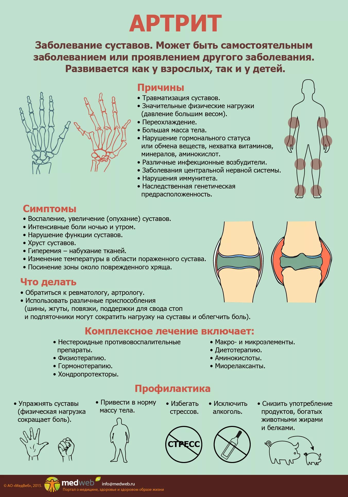 Профилактика артрита. Профилактика ревматоидного артрита. Памятка для больных ревматоидным артритом. Болезнь суставов у взрослых