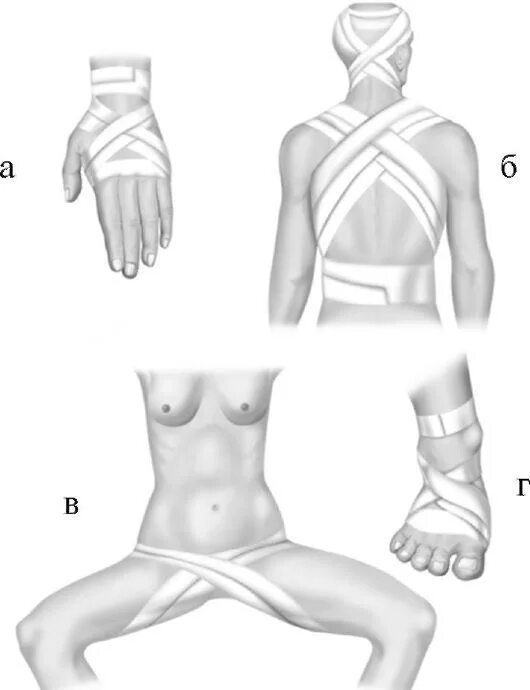Повязка бинтом черепашья. Черепашья повязка на коленный сустав. Перевязка эластичным бинтом. Крестообразная повязка на локтевой сустав. Как перебинтовать эластичным