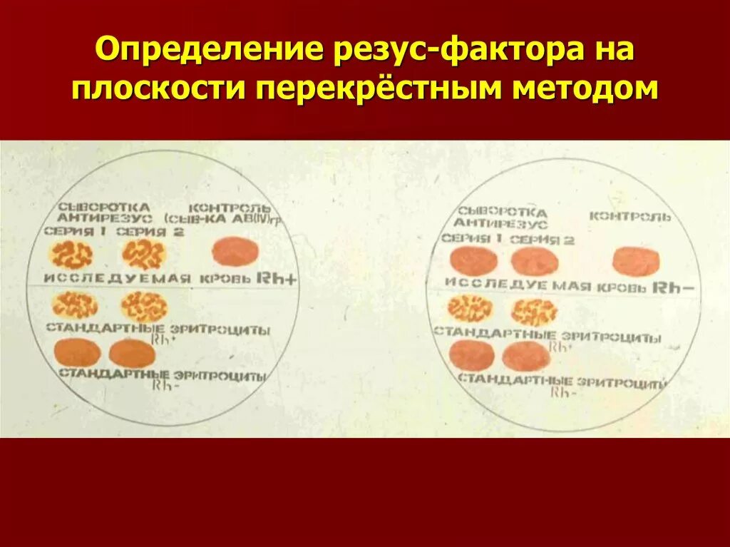 Определение d резус определение. Метод определения резус фактора крови. Экспресс методы определения резус фактора. Определение резус факт. Опрелелениерезусфактора.