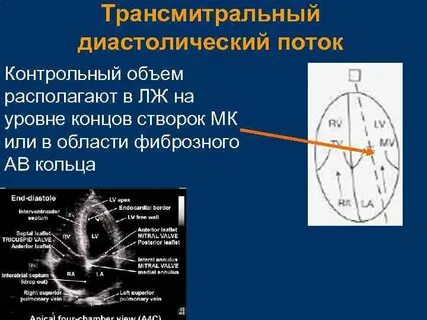 Сердце потока