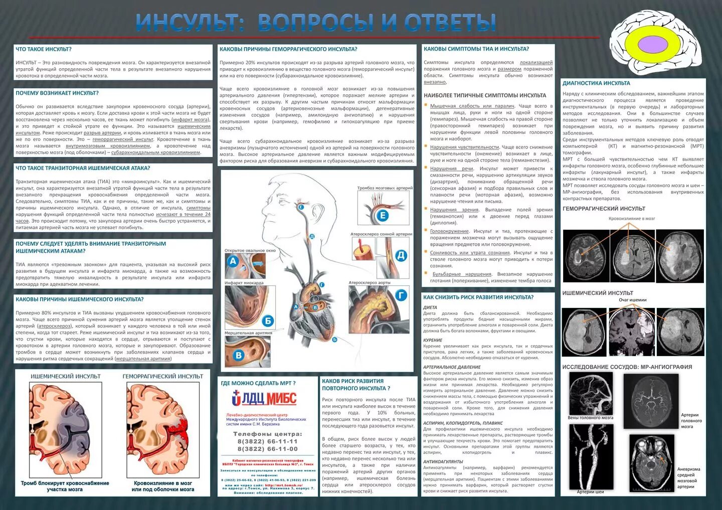 Инсульт вопросы ответы. Транзиторная ишемическая атака головного мозга симптомы. Инсульт вопросы. Тиа или инсульт. Буклет мрт.