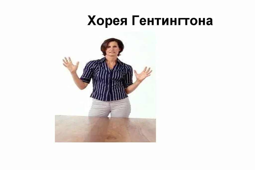 Хорея Гентингтона. Болезнь Гентингтона. Хорея Гентингтона картинки. Болезнь пляска святого