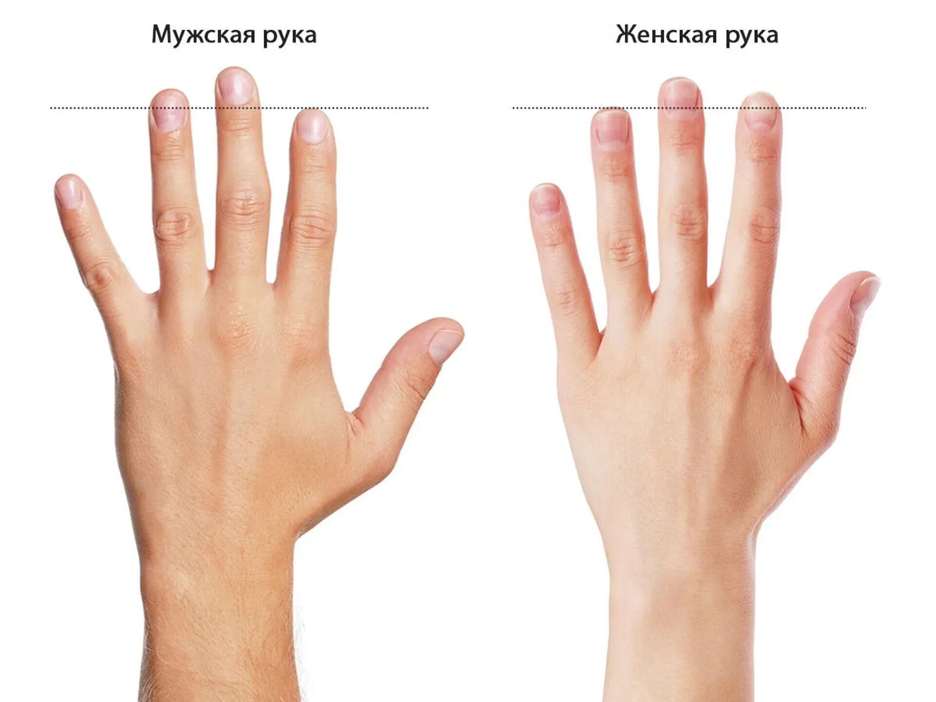 Форма пальцев. Мужская рука. Кисть руки. Узелки гебердена и бушара на пальцах рук. Ногти без покрытия.