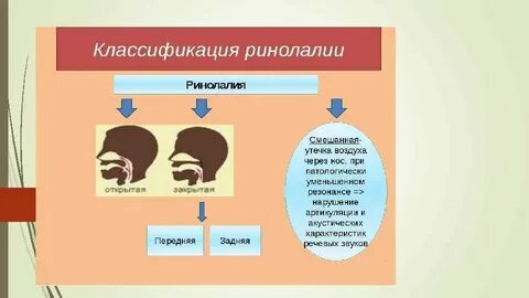 Формы ринолалии