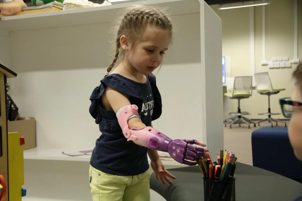 Моторика организация. Компания моторика бионические протезы. Детские протезы рук. Дети с протезом руки. Тяговый протез руки.