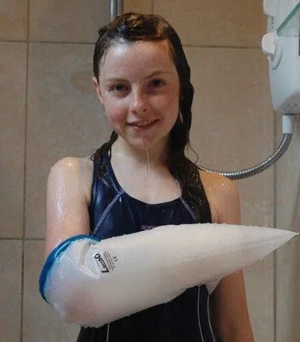 Можно снять гипс чтобы помыться. Чехол на гипс на руку. чехол на гипс на руку детский. водонепроницаемый чехол на гипс на руку детский. водонепроницаемый чехол для гипса на руку.