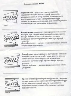 Классы аномалий