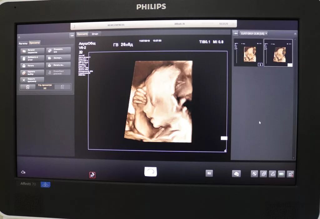 Узи в балашихе. Врачи балашихи педиатры. Педиатр в балашихе. Балашихинский диагностический центр. В.