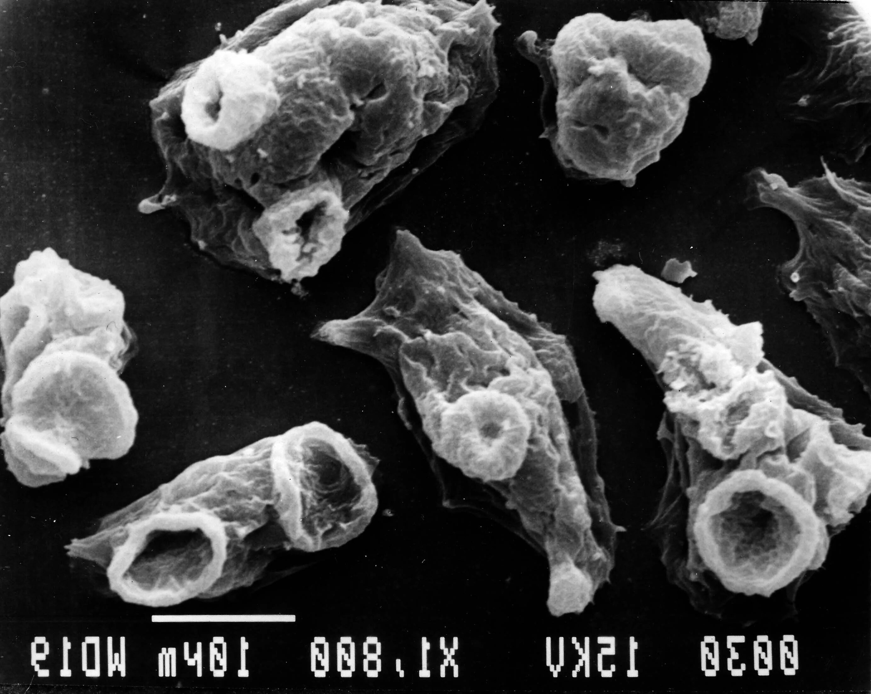 Амеба naegleria где обитает. Naegleria fowleri жизненный цикл. Амеба неглерия фоулера. Жизненный цикл неглерии фоулера. Жизненный цикл неглерии фоулера.