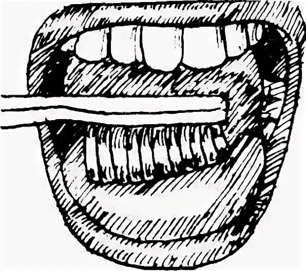 Техника обработки полости рта. Обработка полости рта тяжелобольного пациента. Гигиена полости рта тяжелобольного. Туалет полости рта тяжелобольного пациента.