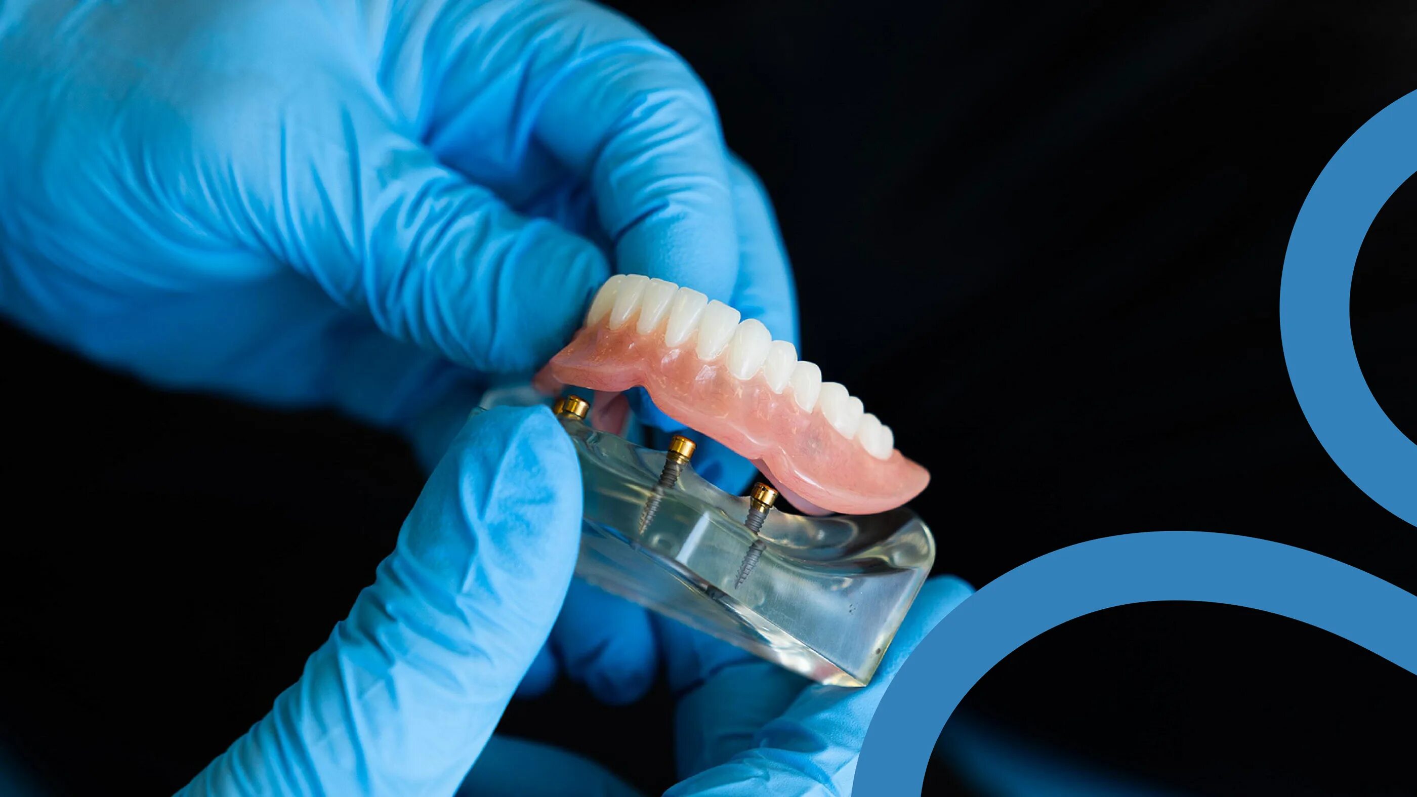 Зубные импланты начали производить в Сургуте