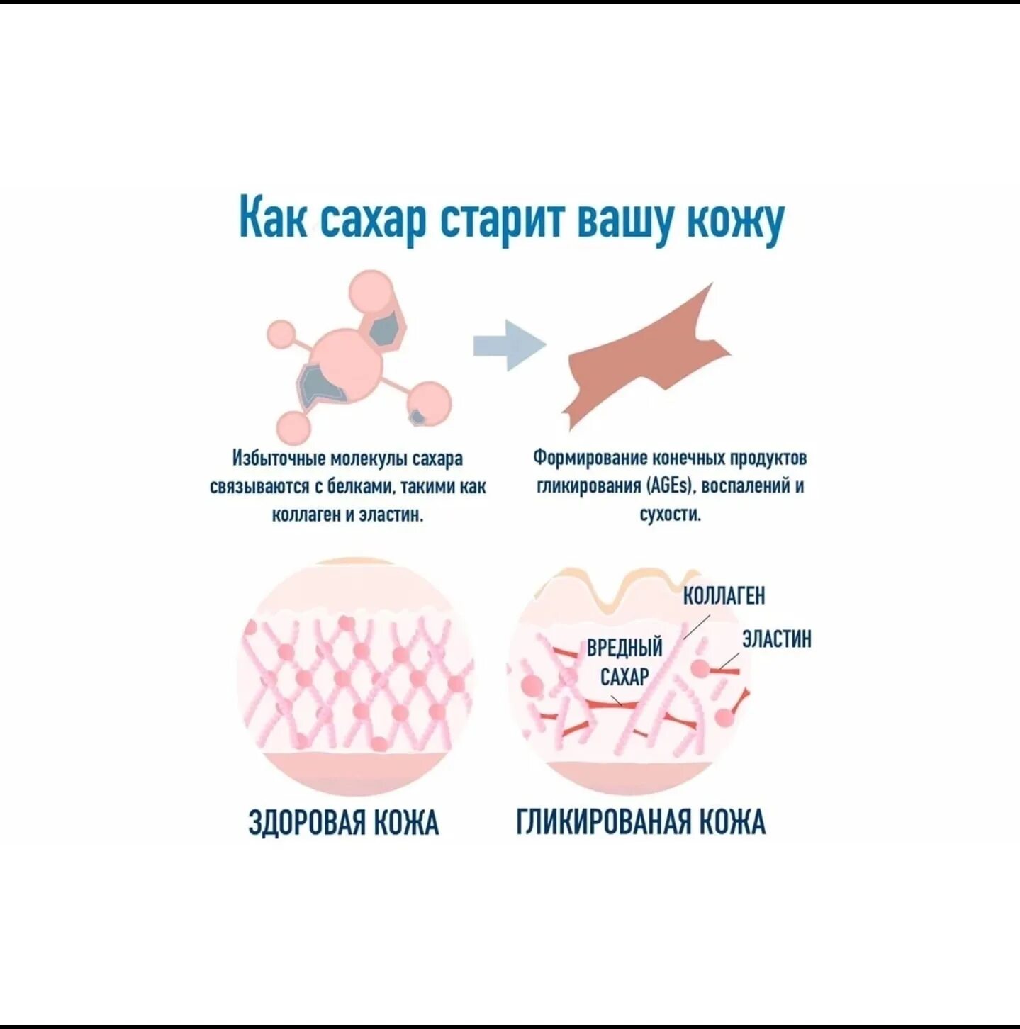 Как работает коллаген. Гликация коллагена. Процесс гликации. Гликация кожи. Сахар и старение кожи.