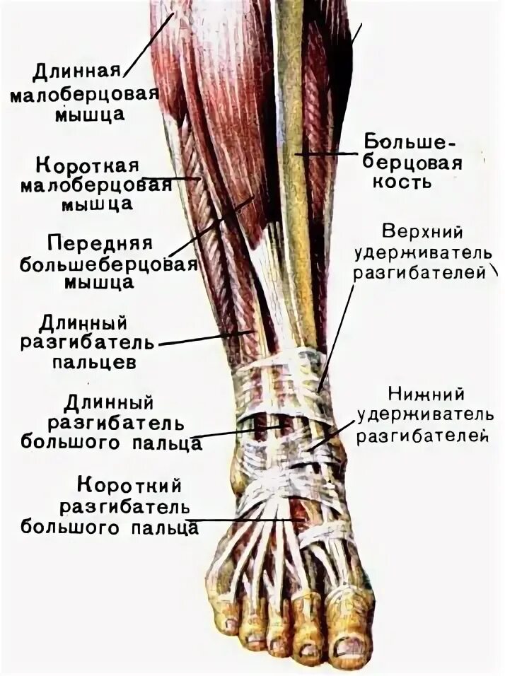 Тендинит малоберцовых сухожилий
