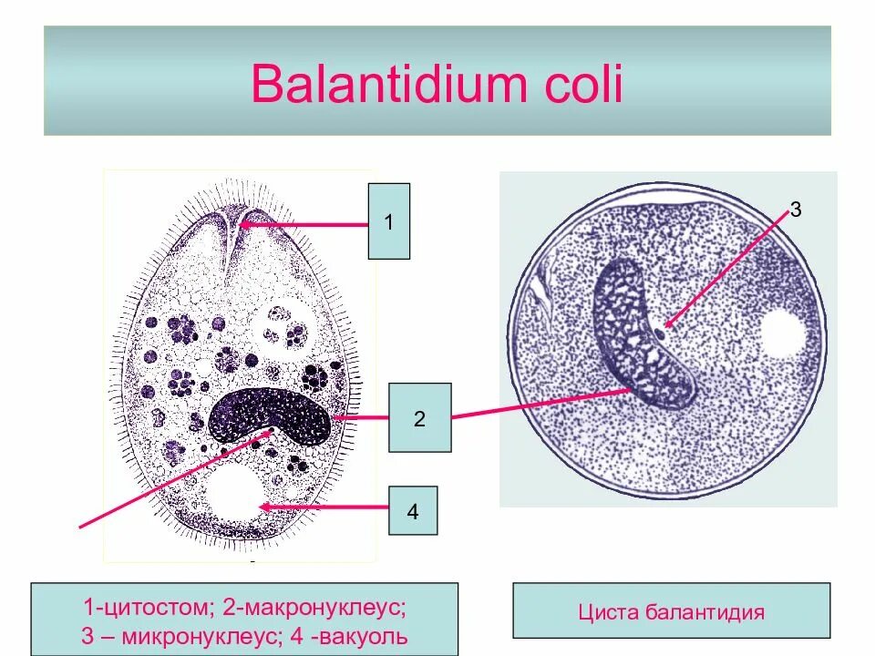 Цисты балантидий свиней. Balantidium coli. Balantidium coli. Balantidium coli. Balantidium coli.