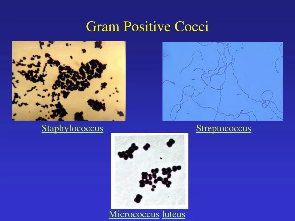 Стрептококки представители. Micrococcus luteus пигмент. Стафилококки и стрептококки. Стрептококитафилококки. Стафилококки и стрептококки грам.