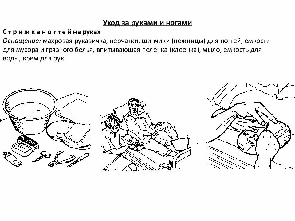 Уход за руками и ногами пациента алгоритм. Уход за руками и ногами пациента. уход за руками и ногами тяжелобольного пациента. стрижка ногтей тяжелобольному пациенту.