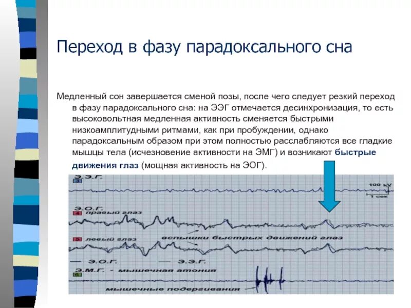 ЭЭГ-корреляты фаз сна.. Фазы сна на ЭЭГ. ЭЭГ медленного сна. Фазы быстрого и медленного сна.