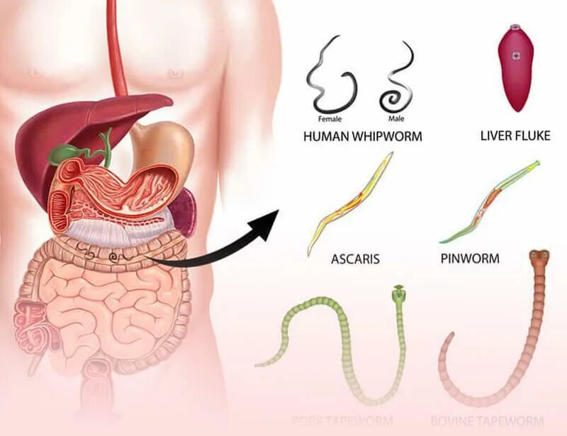 В кишечнике человека обитают. Кишечные черви остирица. В толстом кишечнике человека обитает. Сапрофитическая микробиота. Паразиты в организме человека гельминты.