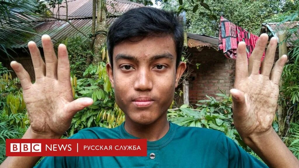 Как живут пальцы