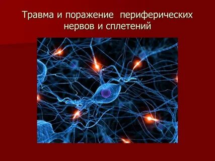 Повреждения периферических нервов и сплетений