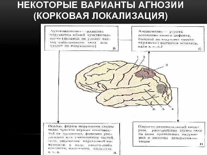 Агнозии локализация. Зрительная агнозия. Лицевая агнозия локализация. Цветовая агнозия локализация. Локализация психических функций в мозге