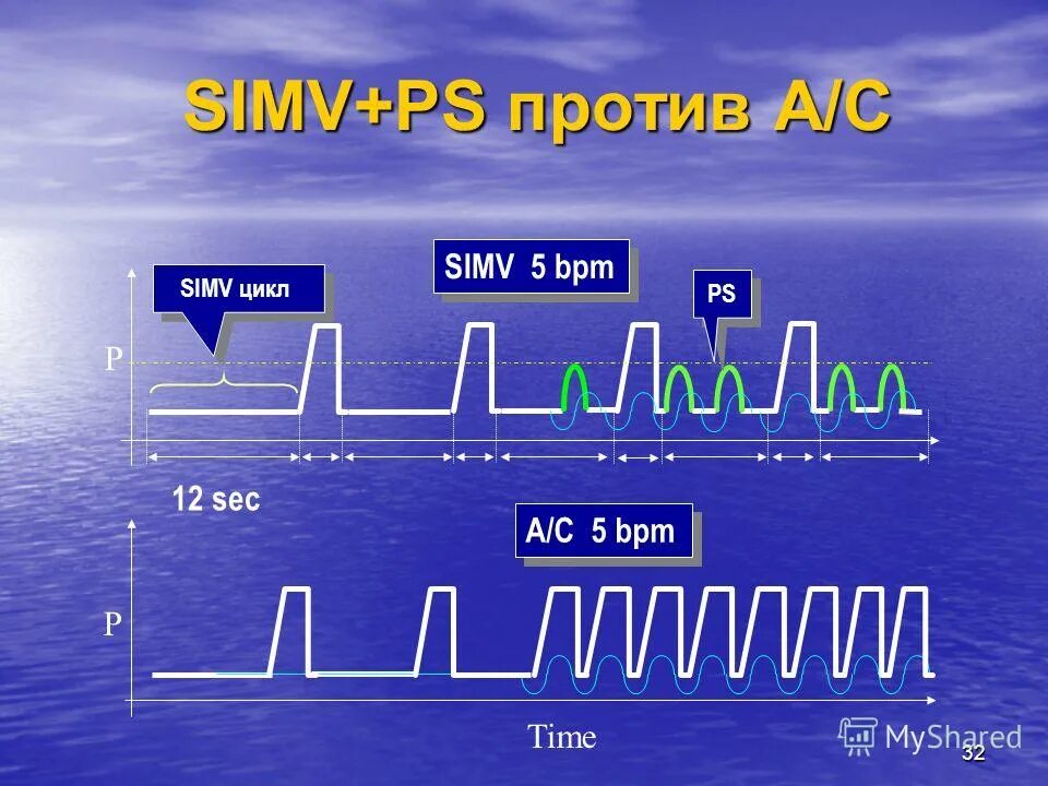 Вентиляционные режимы. SIMV режим вентиляции. Параметры SIMV. Режим SIMV+PS. Режим SIMV PC.