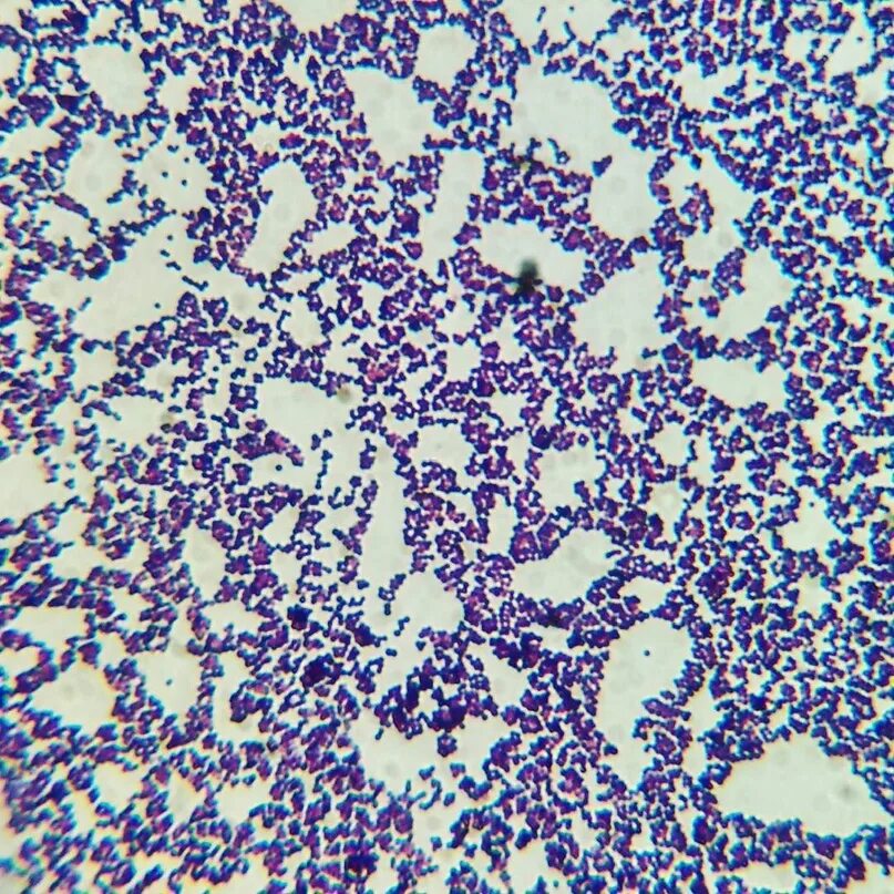 Staphylococcus aureus 5. Стафилококк ауреус микроскоп. Стафилококк ауреус микробиология. Эпидермальный стафилококк микроскопия. Стафилококки генцианвиолет.