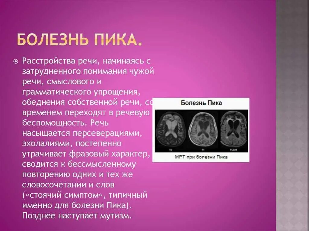 Болезнь пика стадии. Клинические проявления болезни пика. Пика почему. Болезнь пика характеризуется атрофией. Клинические проявления болезни пика.