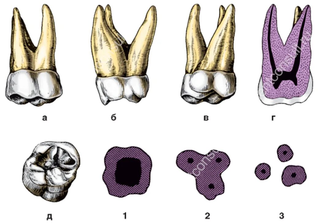 1 Моляр верхней челюсти анатомия. Анатомия 1 верхнего моляра. Зуб первый моляр верхней челюсти.