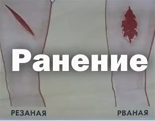 Виды осколочных ранений. Раненая типе