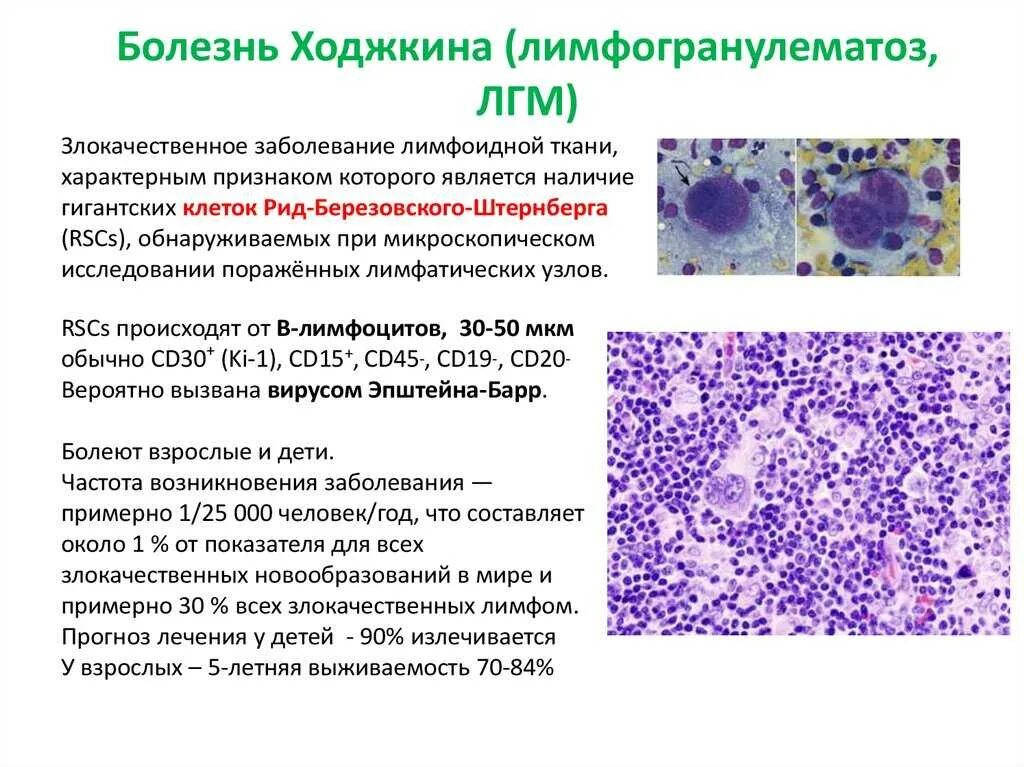 Умеренная местами выраженная лейкоцитарная инфильтрация