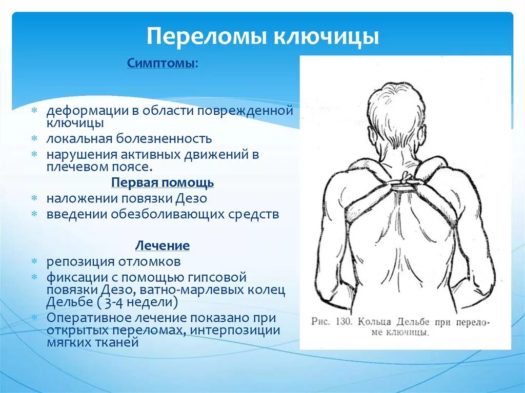 Локальный статус позвоночник. Винтообразный перелом ключицы. Осложнения перелома ключицы. Признаки перелома ключицы.