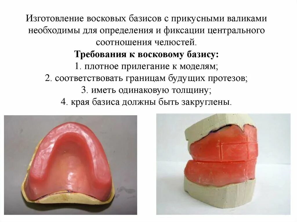 Толщина базиса. Восковые базисы с окклюзионными валиками из воска.. Восковой Базис с окклюзионными валиками. Окклюзионный валик воскового базиса. Требования к восковым базисам с окклюзионными валиками.