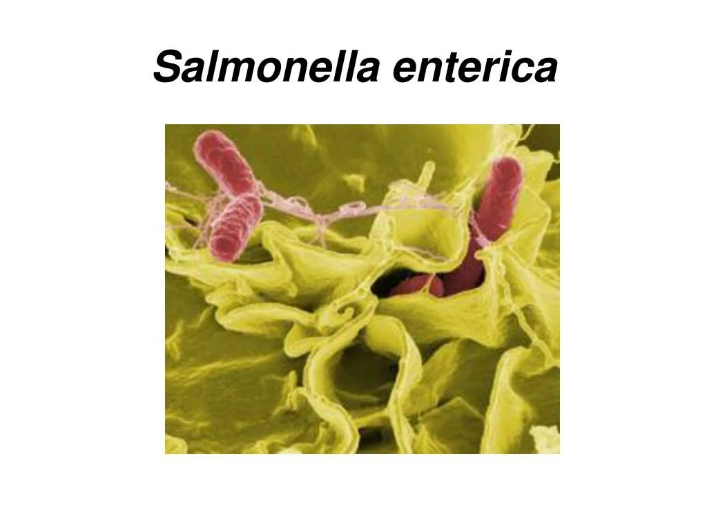 Salmonella enterica. Salmonella enterica морфология. Сальмонелла энтерика. Сальмонелла энтерика микробиология. Сальмонелла ентеритидис.