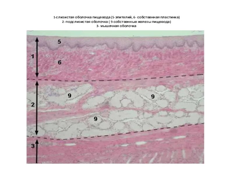 Поперечный срез пищевода гистология. Эпителий пищевода гистология. Стенка пищевода гистология. Гистология пищевода слизистой оболочки. Слои пищевода