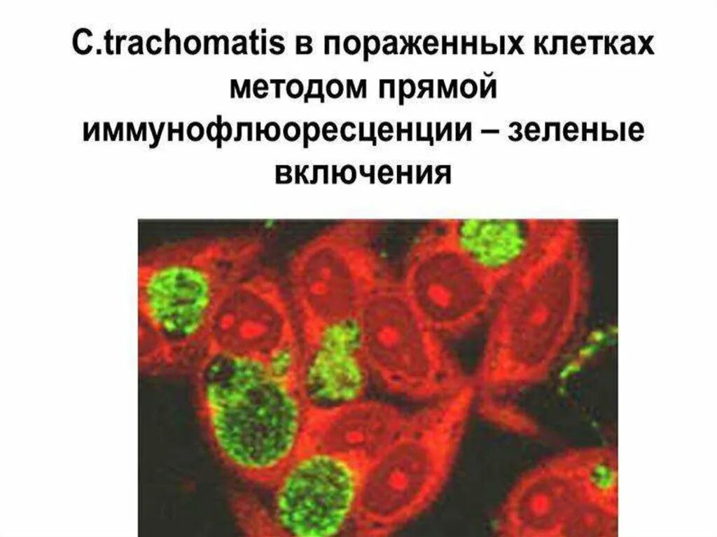 Респираторный хламидиоз. Возбудитель респираторного хламидиоза. Респираторный хламидиоз микробиология. Профилактика респираторного хламидиоза.