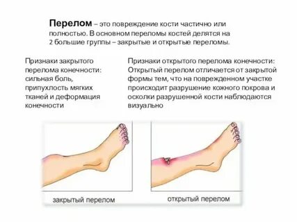 Ответы нмо открытая рана голени по утвержденным