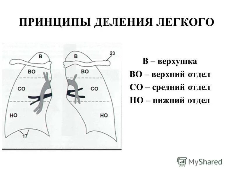 сегменты левого лёгкого схема. сегмент s3 правого легкого располагается. доли легкого на рентгенограмме. 2 3 отделы легких. 2 3 отделы легких.