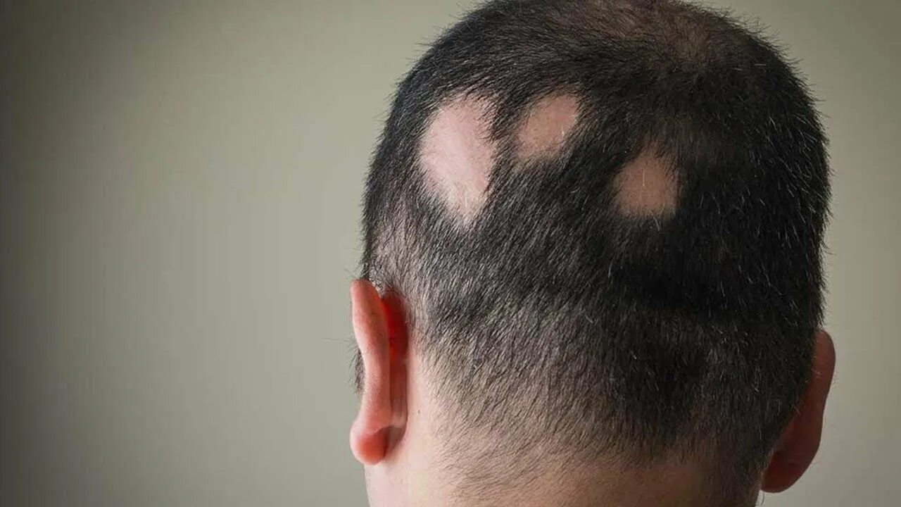 Выпадают чтобы на их. Выпадают чтобы на их