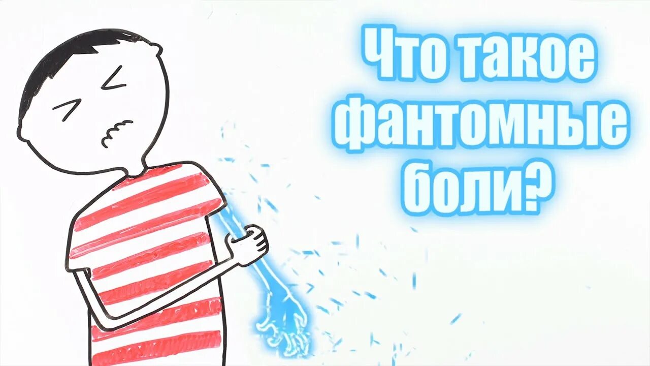 Фантомные боли. Фантомный синдром. ФО нтомные Бодт.