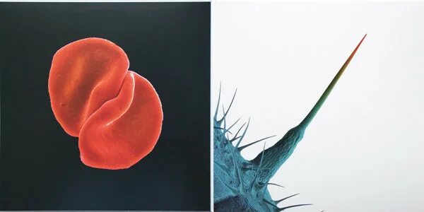 Scratch your back. Peter gabriel scratch. peter gabriel scratch my back 2010. peter gabriel scratch my back. peter gabriel - and i&#039;ll scratch yours (2013).
