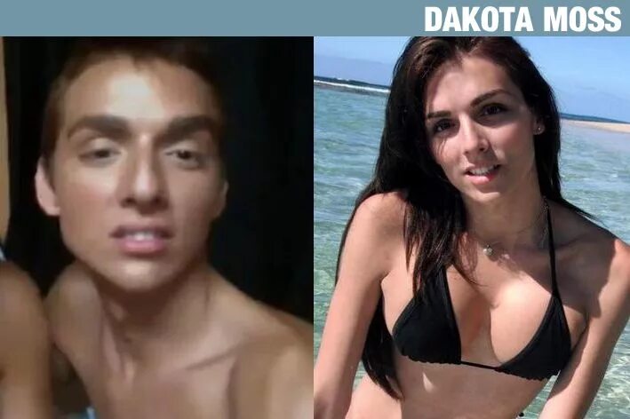 I had trans surgery to become a woman at 19... four years later I'm back being a