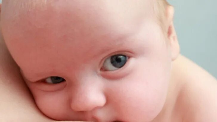 Припухлость глаз у новорожденных. Мешки под глазами у новорожденного. Отечность под глазами у грудничка. Мешки под глазами у грудничка.