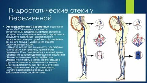 Отекают беременным