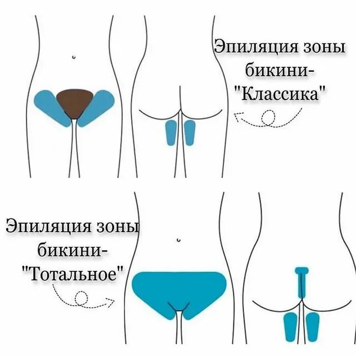 Чем отличается бикини от тотального бикини. Эпиляция бикини классика. тотальное бикини. эпиляция тотальное бикини. зона классического бикини.