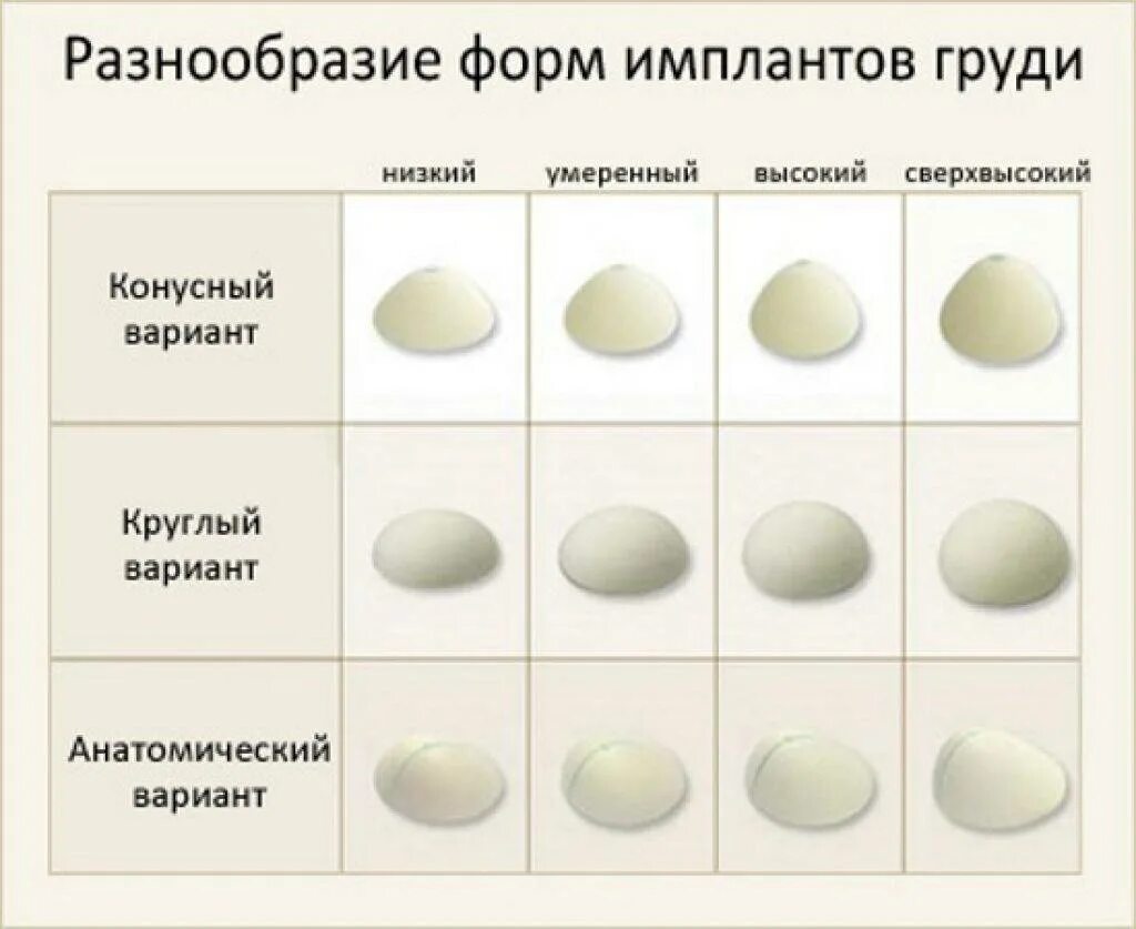 Импланты грудных желез. Формы имплантов грудных. Виды имплантов груди. Форма груди импланты. Формы силиконовых имплантов.