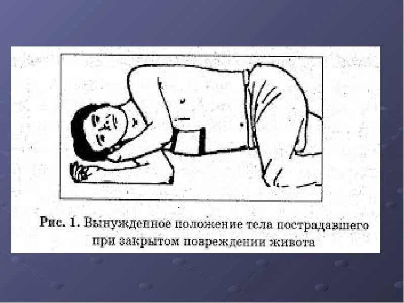 Положение при холецистите. Вынужденное положение пациента. положение пациента при травме живота. положение больного при. положение пациента при аппендиците.
