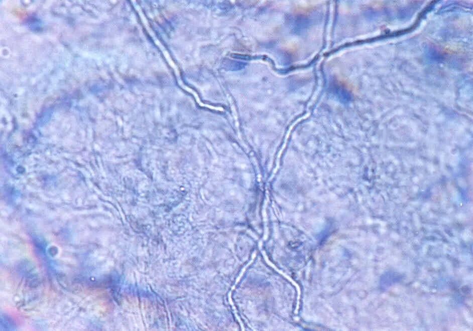 Мицелий гриба микроскопия. Нити мицелия микроскопия. Септированный мицелий микроскопия. Мицелий грибов микроскопия. Мицелий грибов на коже